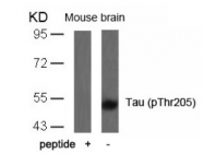 AP02400PU-S - MAPT / TAU