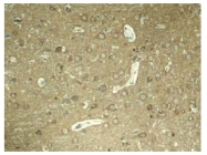AP02404PU-S - MAPT / TAU