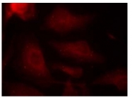 AP02404PU-S - MAPT / TAU