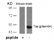 AP02404PU-S - MAPT / TAU