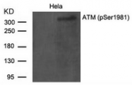 AP02410PU-S - ATM