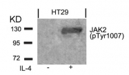 AP02435PU-S - Tyrosine-protein kinase JAK2