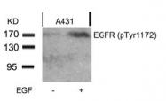 AP02479PU-S - EGFR / ERBB1