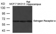 AP02606PU-N - Estrogen receptor alpha