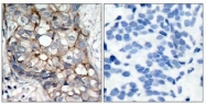 AP02613PU-S - EGFR / ERBB1