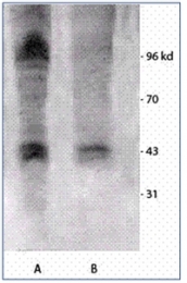 AP03034SU-N - Phosphothreonine