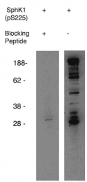 AP05255PU-N - Sphingosine kinase 1 (SPHK1)