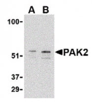 AP05605PU-N - PAK2