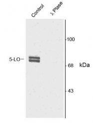 AP05762PU-N - ALOX5 / LOG5