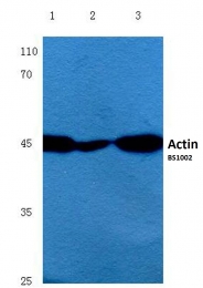 AP06000PU-N - pan Actin
