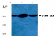 AP06001PU-N - alpha skeletal muscle Actin / ACTA1