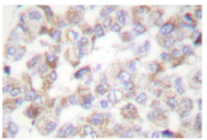 AP06001PU-N - alpha skeletal muscle Actin / ACTA1