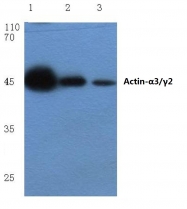 AP06002PU-N - gamma 2 smooth muscle Actin / ACTG2