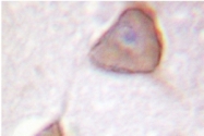 AP06003PU-N - Alpha-Adducin / ADD1