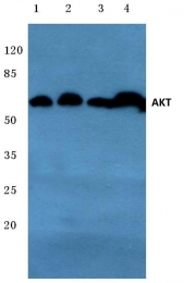 AP06004PU-N - AKT1 / PKB