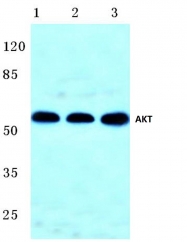 AP06005PU-N - AKT1 / PKB
