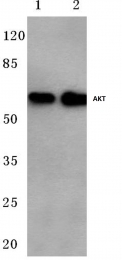 AP06006PU-N - AKT1 / PKB