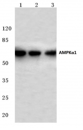 AP06008PU-N - PRKAA1