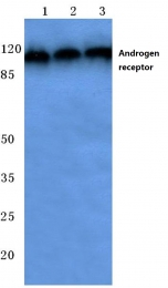 AP06011PU-N - Androgen receptor