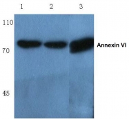 AP06012PU-N - Annexin A6 / ANXA6