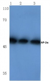 AP06013PU-N - TFAP2A / AP-2 alpha