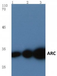 AP06016PU-N - ARC / ARG3.1