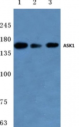 AP06017PU-N - MEKK5 / ASK1