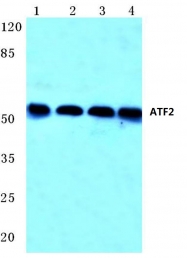 AP06020PU-N - ATF2