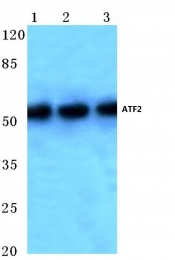 AP06022PU-N - ATF2