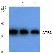 AP06024PU-N - ATF4