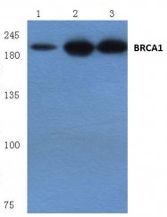 AP06033PU-N - BRCA1 / RNF53