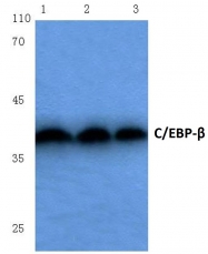 AP06034PU-N - CEBPB