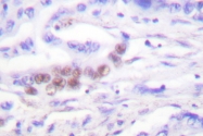 AP06034PU-N - CEBPB