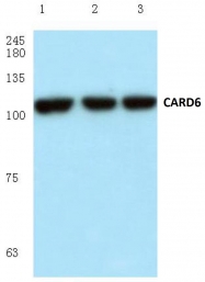 AP06035PU-N - CARD6
