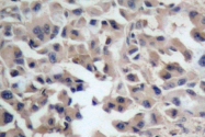 AP06038PU-N - Catenin beta-1
