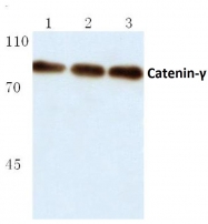 AP06039PU-N - Junction plakoglobin