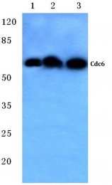 AP06045PU-N - CDC6