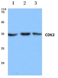 AP06047PU-N - CDK2