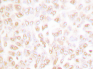 AP06047PU-N - CDK2