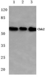 AP06051PU-N - CHK2