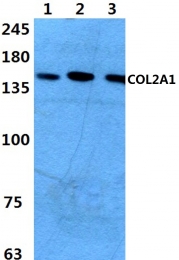 AP06068PU-N - Collagen type II alpha 1 chain