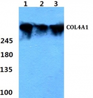 AP06069PU-N - Collagen type IV