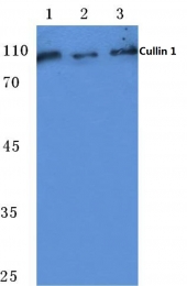AP06077PU-N - Cullin 1