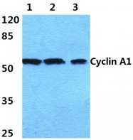 AP06080PU-N - Cyclin A1