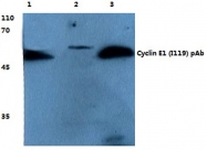 AP06081PU-N - Cyclin E1