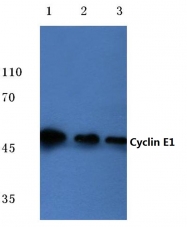 AP06082PU-N - Cyclin E1