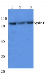 AP06083PU-N - Cyclin F