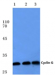 AP06084PU-N - Cyclin G1