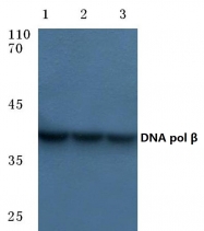 AP06087PU-N - DNA polymerase beta