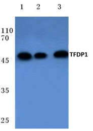 AP06089PU-N - TFDP1